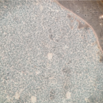 Biofilm