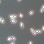Brettanomyces