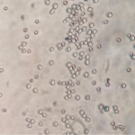 Saccharomyces cerevisiae