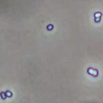 pediocropped2